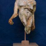 Woman with Cleft Lip 4 by Veronica Huacuja