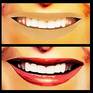 After...X...Before MOUTH~SMILE area