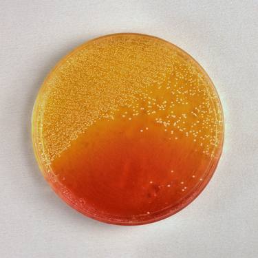 A) Petri dish pending identification. 1982. Limited Edition of 5. thumb