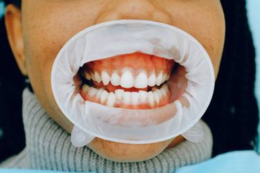 Original Photorealism Performing Arts Photography by Dr Richard Halpern Orthodontist Calgary