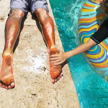 Sunburnt legs by the pool thumb