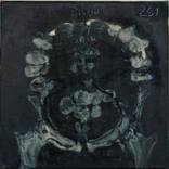 Nuclear Tales. Xray by K Sesk