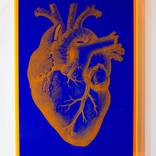 Pop Heart (Orange and Blue) by Ernesto Romano