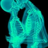 Collection X-Ray series