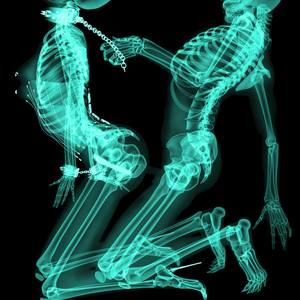 Collection X-Ray series