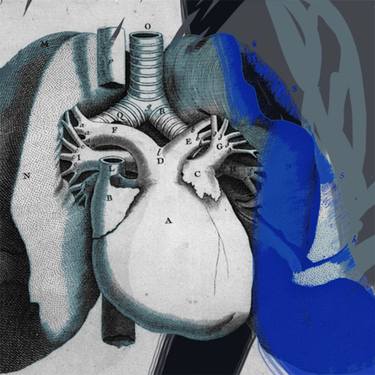 Coeur anatomie - Edition 1 of 5 thumb