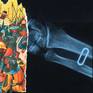 detail of Roman warriors - game of transparency due to the nature of the X-ray image