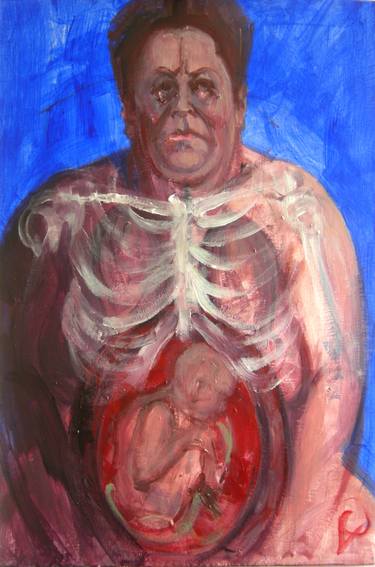 'Radiographie du Foetus' by M. Harrison-Priestman - acrylic on aluminium, 48 x 32 cm, 2017. thumb