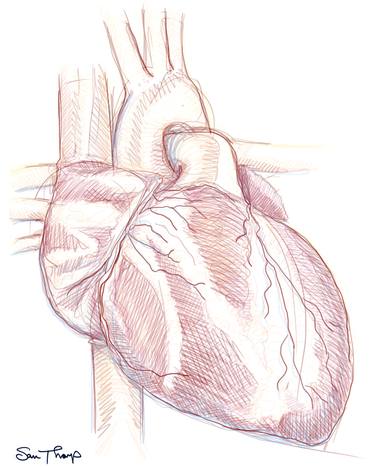 Ventricle thumb