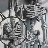 Plastic Bones by Steve Lawson