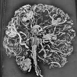 Brain Child by Charlie Tuesday Gates