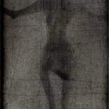 self-Portrait 34 by Simona Umaraite