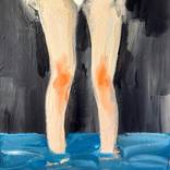 Water Heals Wounds by Zakhar Shevchuk