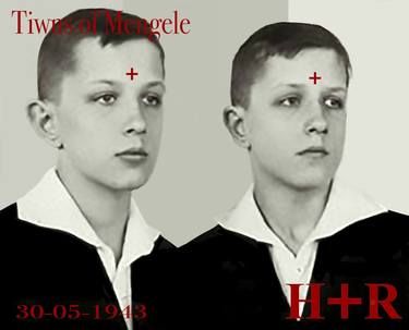 Twins of Mengele thumb