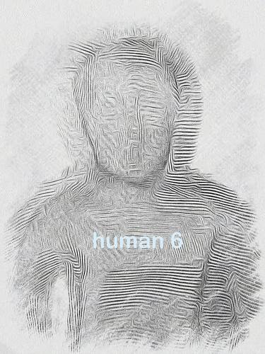 multiple human 6 thumb